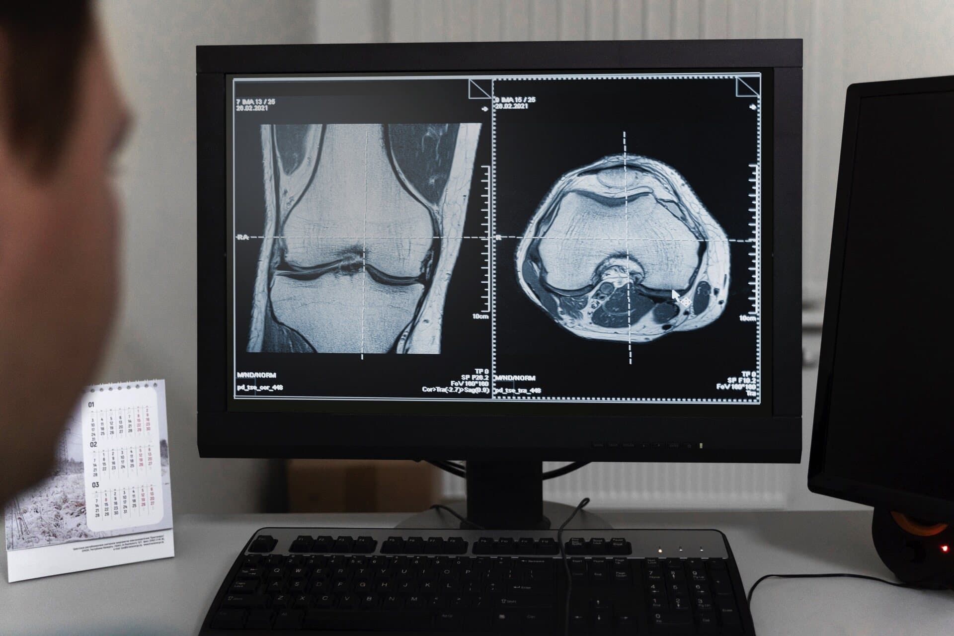 High-resolution knee MRI scan